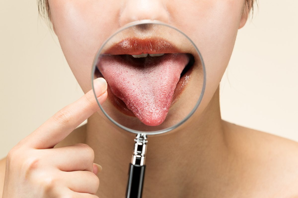 Prueba del Gusto o Electrogustometria en parálisis facial